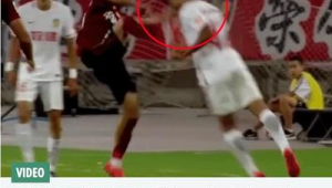 被足球爆头问题大吗?关乎安全需重视足球运动潜在风险