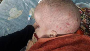 脑积水孩子能踢足球吗高中