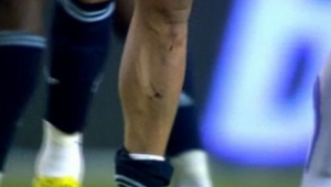 女生练足球是否要带护腿板？这些要点告诉你答案