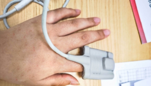 缺铁性贫血能踢足球吗