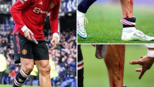 C罗踢足球时是否佩戴护腿板，背后隐藏着怎样的秘密？