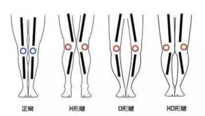 女生踢足球腿会变形吗？真相来了！