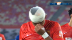 足球撞到嘴上会受伤吗？带你了解其中的潜在风险与应对