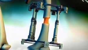 双腿断了还能在中国踢足球吗