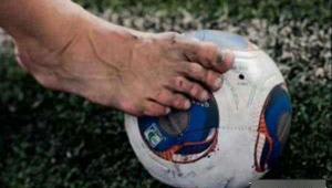 踢足球脚上长出茧子正常吗